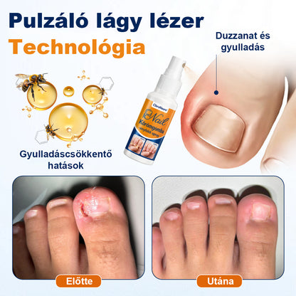 🛡️CleraNaure® körömgomba-ellenes spray