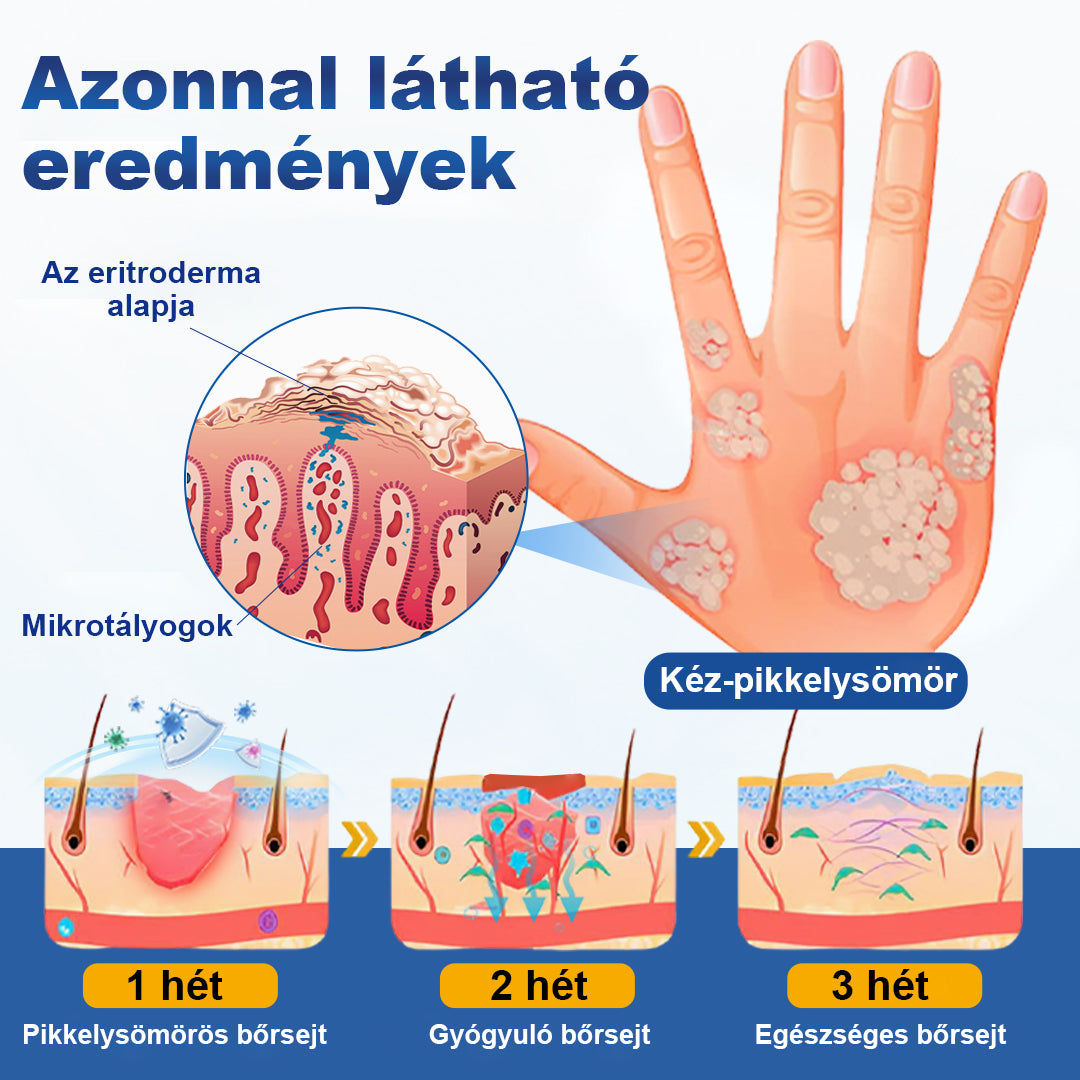 🥇CleraNaure® PsoriaMucin Dörzsölésmentes Viszketés- és Pikkelyenyhítő Permet