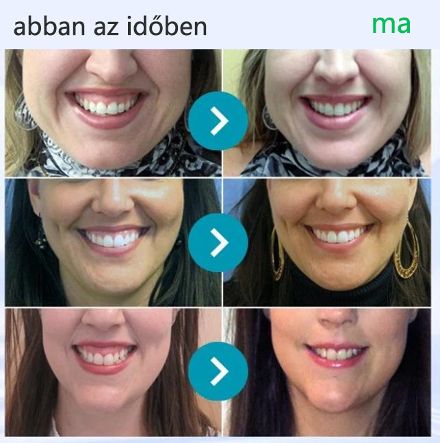 🪐CleraNaure® VioCore Méregtartalmú Fogászati Kezelő Fogkrém
