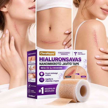 🥇CleraNaure® Hyaluronsavas Nanomikrotű-hegjavító Tapasz