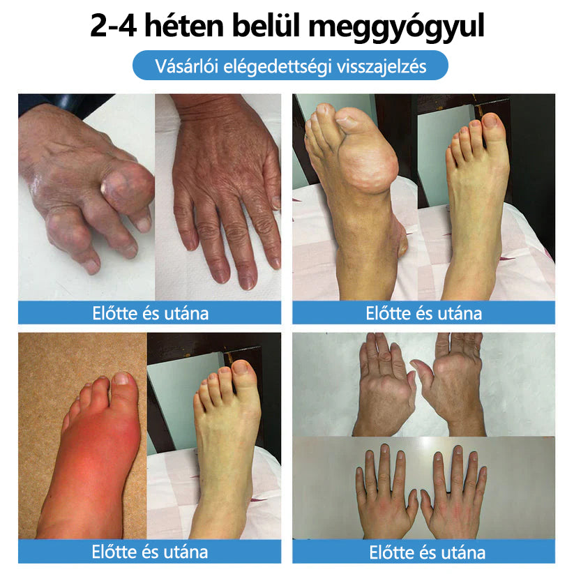 🥇ClearaNature® Nano-tűs közös tapasz