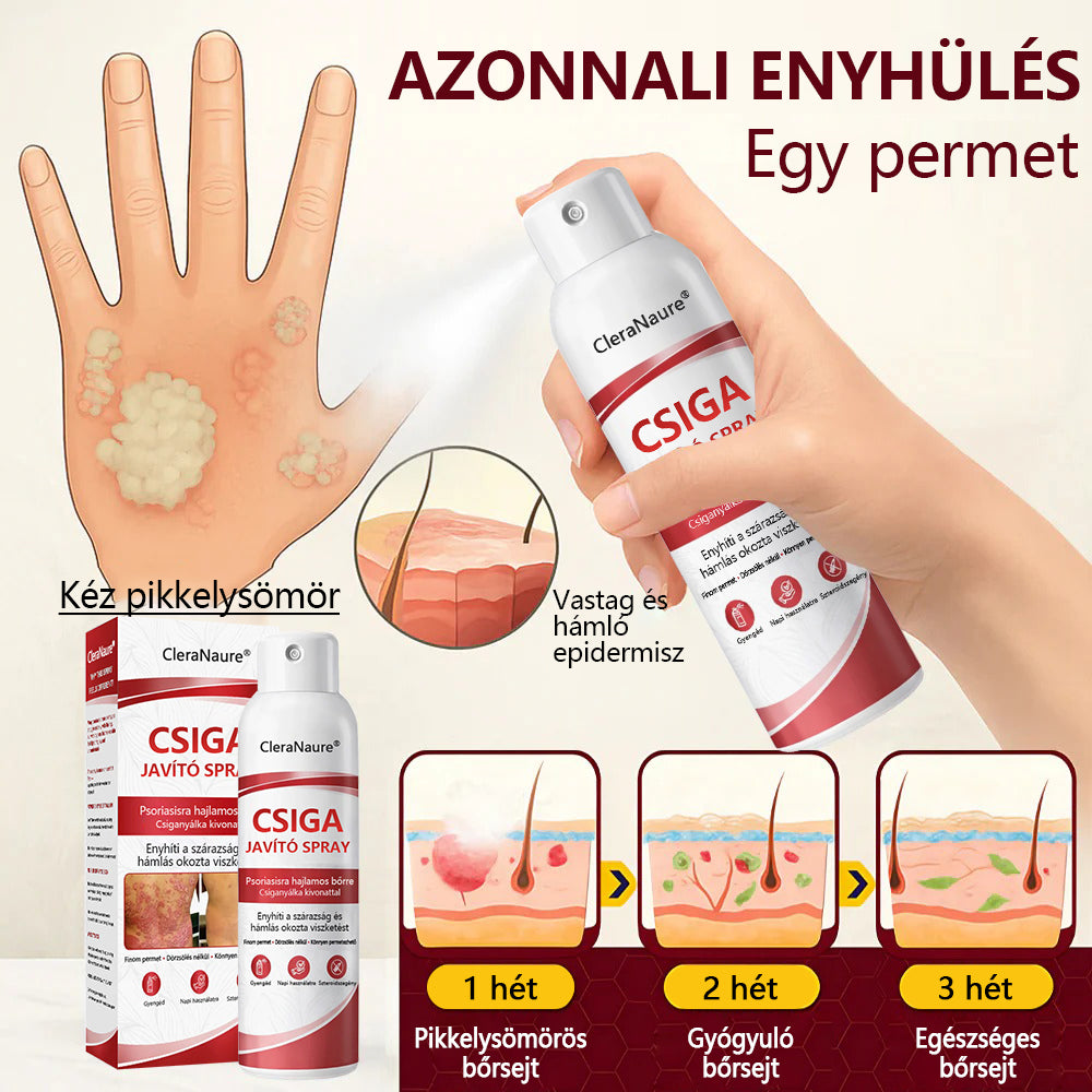 ✨CleraNature® Bálnazsír Spray Viszkető, Hámló Psoriasisra Hajlamos Bőrre