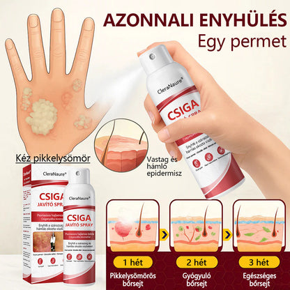 ✨CleraNature® Bálnazsír Spray Viszkető, Hámló Psoriasisra Hajlamos Bőrre