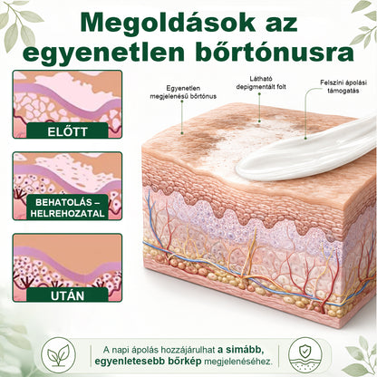 CleraNaure® Növényi Vitiligo Krém