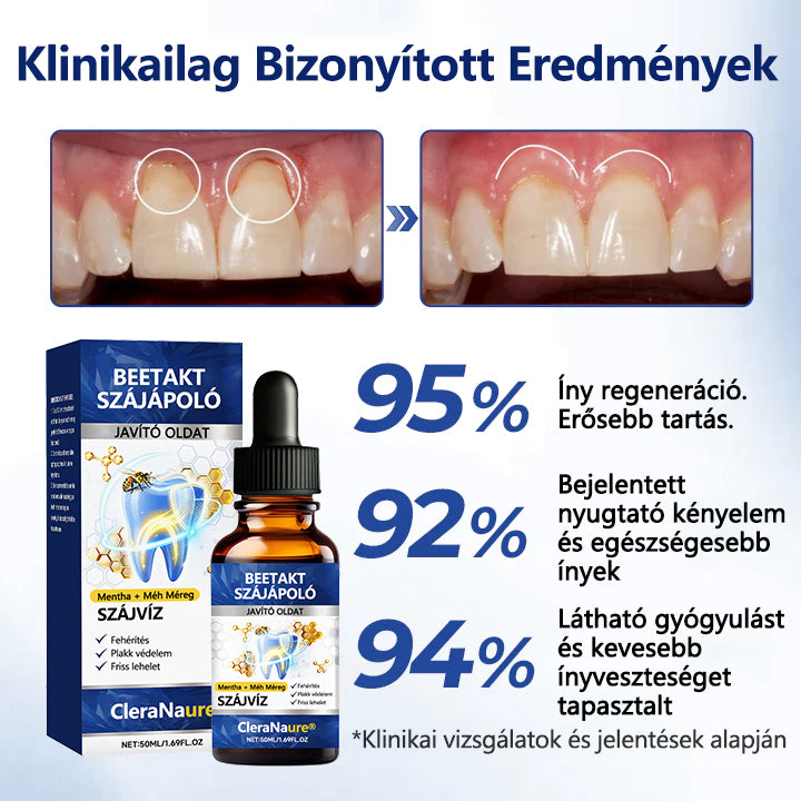 ✨CleraNaure® BeeTakt Szájápoló Javító Oldat