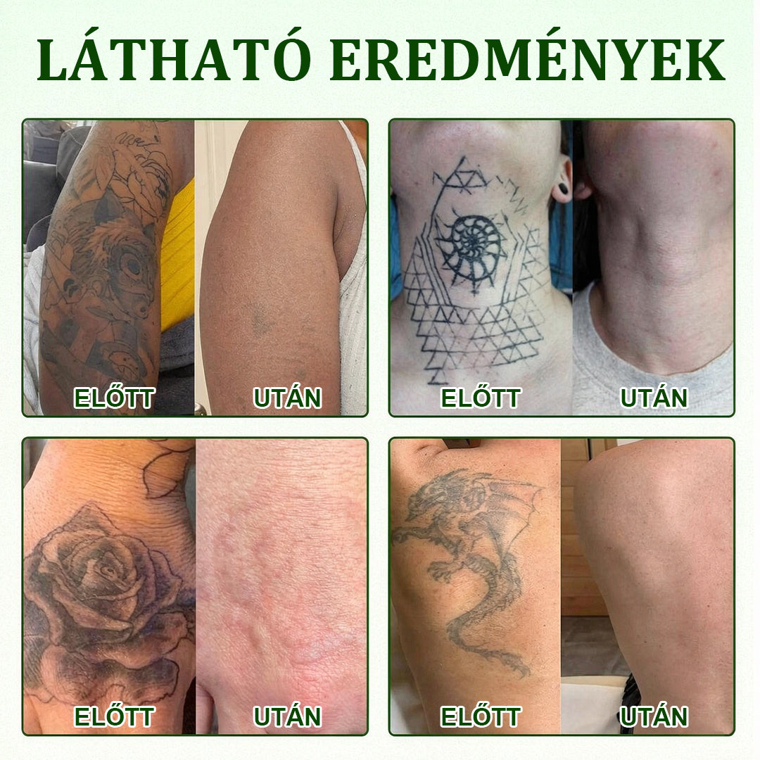 🛡️CleraNaure® Tiszta Algás Festékeltávolító Támogató Spray 🌿 — Búcsúzz el a régi tetoválópigmentektől 💚, Halványítsd a makacs festéket ✨, Helyreállítja és kisimítja a kezelt bőrt 💧, Lézermentes ✅, Próbáld ki most! 🔥