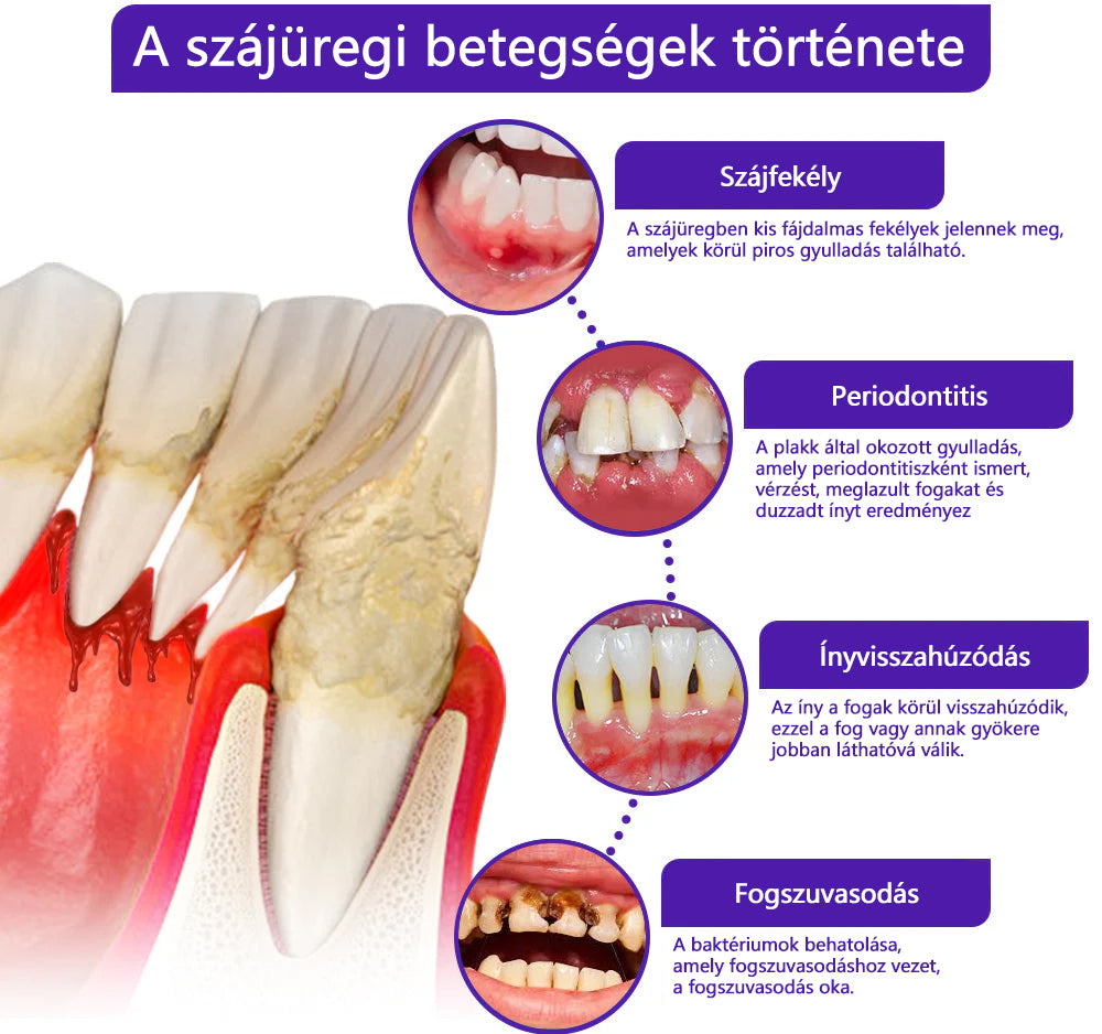 🪐CleraNaure® VioCore Méregtartalmú Fogászati Kezelő Fogkrém