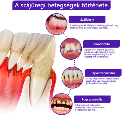 🪐CleraNaure® VioCore Méregtartalmú Fogászati Kezelő Fogkrém