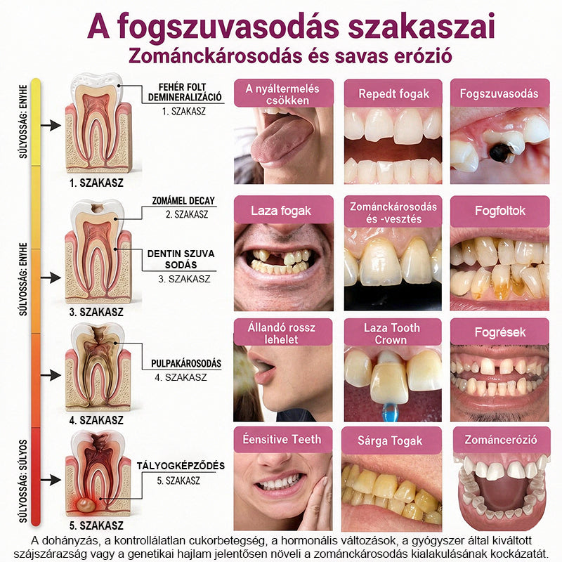 CleraNaure® DenPerm Üregjavító Természetes Zománctömő Gél