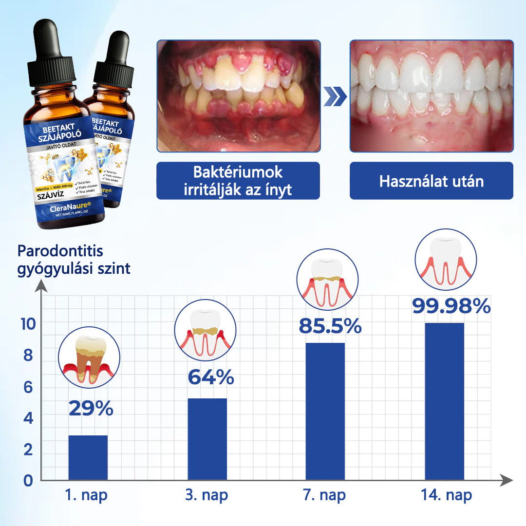 ✨CleraNaure® BeeTakt Szájápoló Javító Oldat