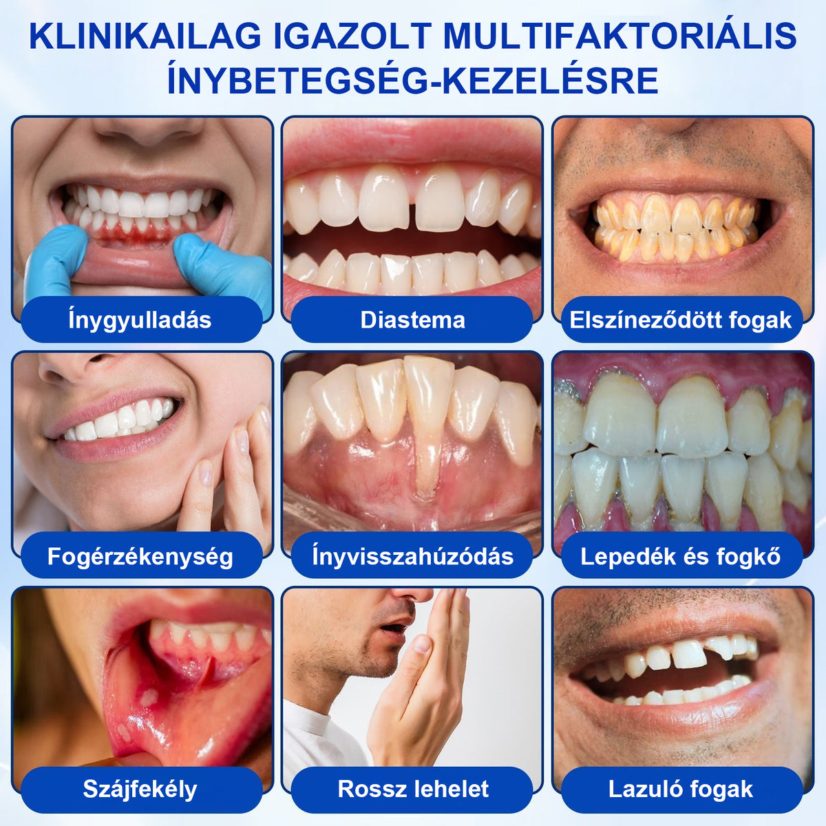 🍀CleraNaure® GumRevive – Fogágy-helyreállító Gél✨