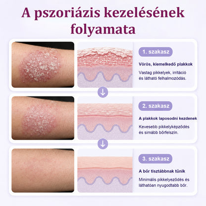 💎CleraNaure® DermaBloom Bőrregeneráló Krém