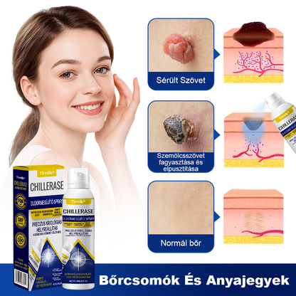 Timilk® ChillErase pattanásmegújító spray