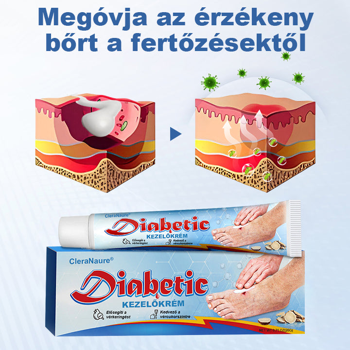 💎CleraNature® VitaGluco Cukorbetegség Kezelő Krém - 👨‍⚕️Bőrgyógyászok Által Ajánlott Formula