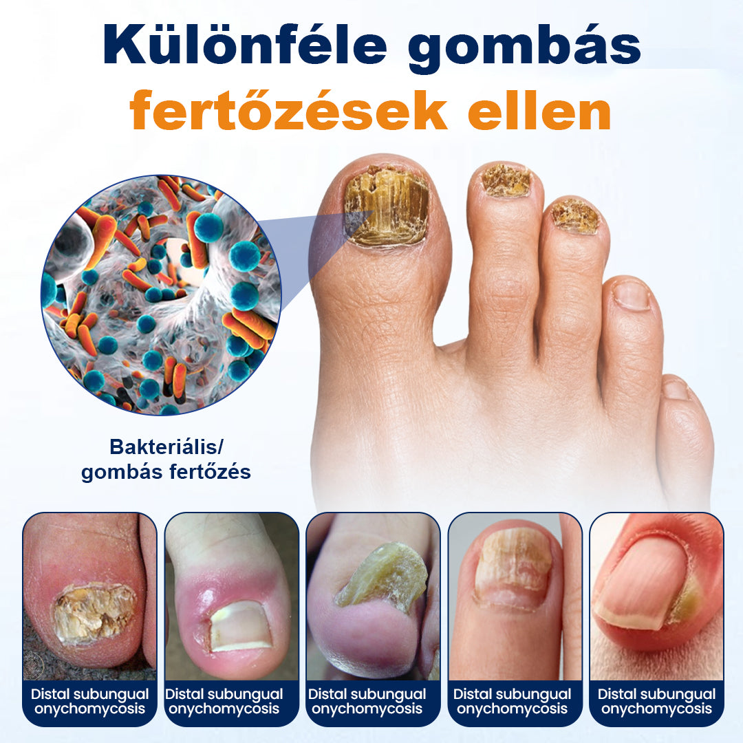 🛡️CleraNaure® körömgomba-ellenes spray