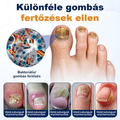 🛡️CleraNaure® körömgomba-ellenes spray
