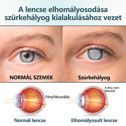 CleraNaure® Optifusion Nano Szemcsepp Szérum-A nanotechnológia visszaállítja a tiszta látást, szemüveg nélkül, műtét nélkül