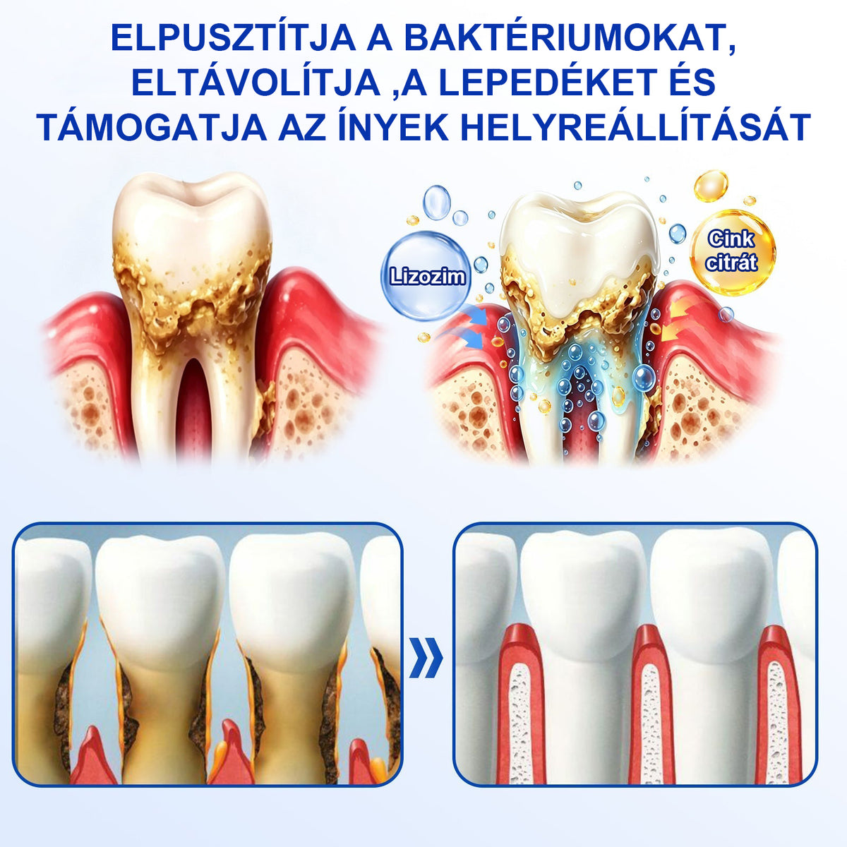 🍀CleraNaure® GumRevive – Fogágy-helyreállító Gél✨