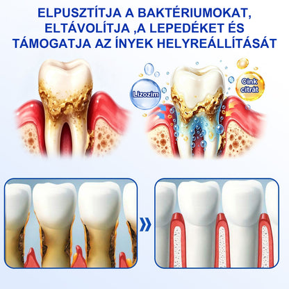 🍀CleraNaure® GumRevive – Fogágy-helyreállító Gél✨