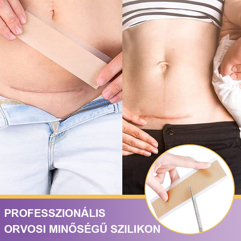 🥇CleraNaure® Hyaluronsavas Nanomikrotű-hegjavító Tapasz