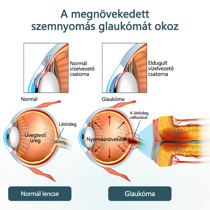 CleraNaure® Optifusion Nano Szemcsepp Szérum-A nanotechnológia visszaállítja a tiszta látást, szemüveg nélkül, műtét nélkül