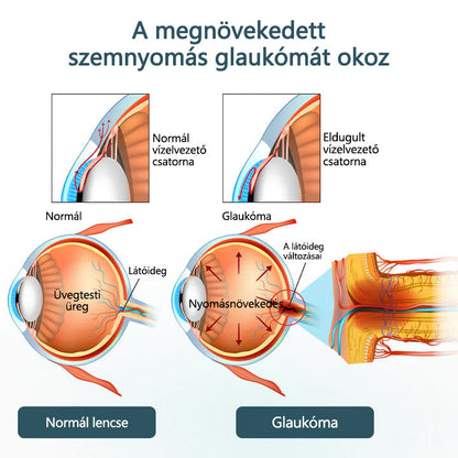 CleraNaure® Optifusion Nano Szemcsepp Szérum-A nanotechnológia visszaállítja a tiszta látást, szemüveg nélkül, műtét nélkül